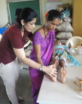 Doctor guiding mother of child for daily physio therapy treatment for her legs